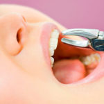 مراقبتهای بعد از کشیدن دندان در کودکان